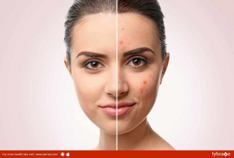 How to get rid from reddening of face skin
