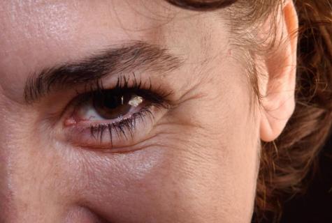 How to get rid of wrinkles under eyes