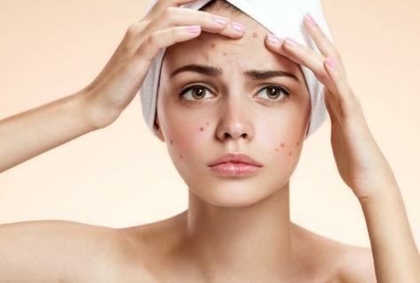 How to get rid of pimples in the house ways