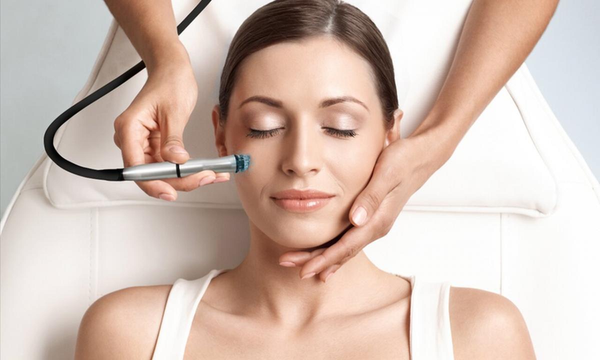 What is microdermabrasion