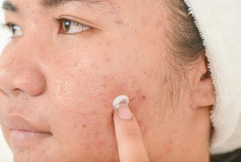 How to remove scars from pimples by means of products
