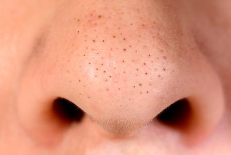 How to get rid of enlarged pores and black dots on face