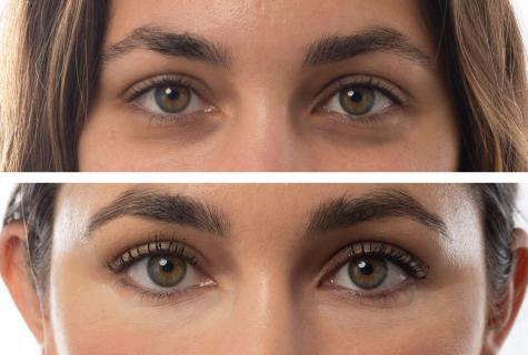 How to pick up cream from wrinkles around eyes