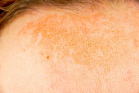 How to get rid of pigmental spots on face in house conditions