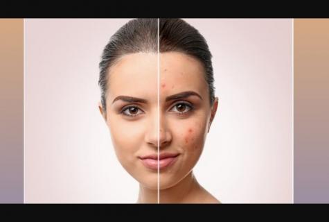 How quickly to remove skin reddening