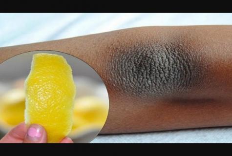 How to get rid of dryness of elbows
