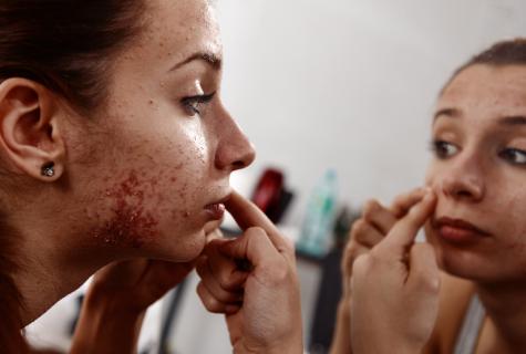 How to struggle with acne rash