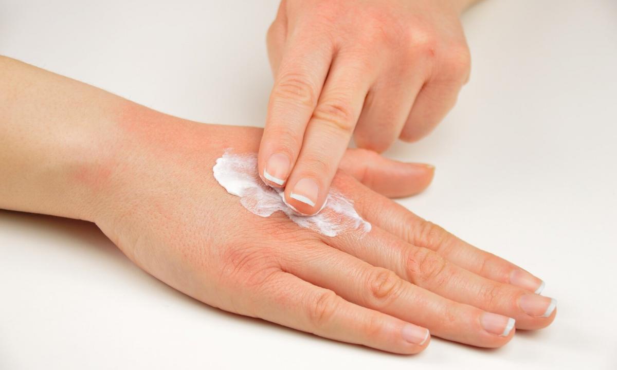 How to choose cream from cracks on hands