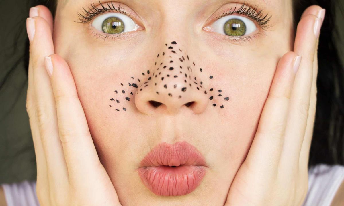 How to get rid of black dots on nose by national methods