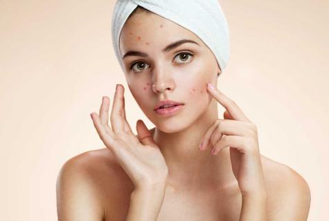 How to choose cream from pimples
