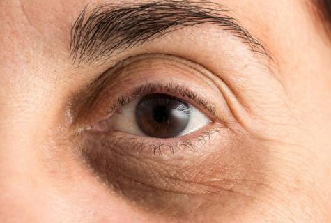 How to remove wrinkles from under eyes