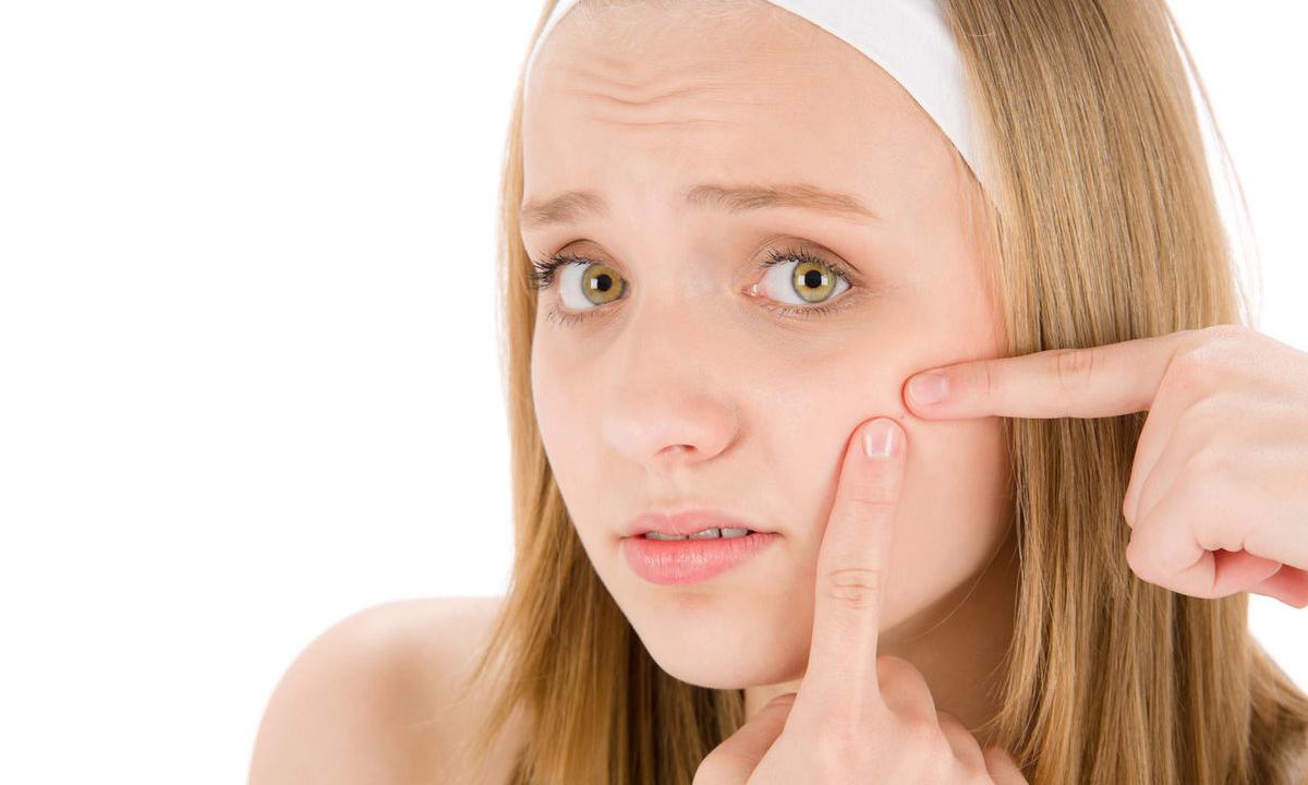 How to get rid of pimples at teenagers