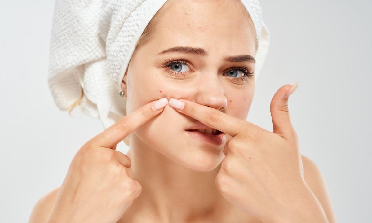 How to treat pimples: cosmetic and/or medical medicines