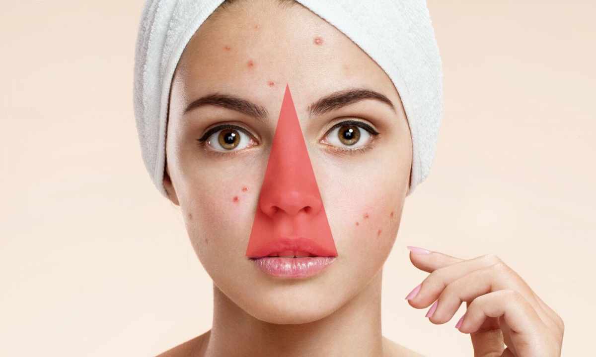 Tsindol is assistant in fight against pimples