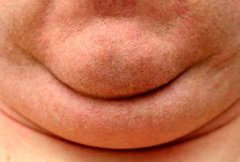How effectively to get rid of the second chin