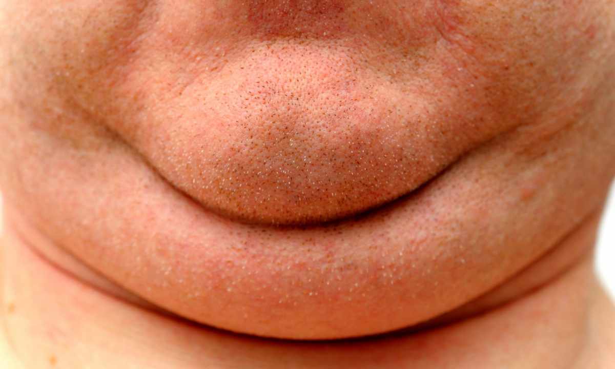 How to get rid quickly of the second chin
