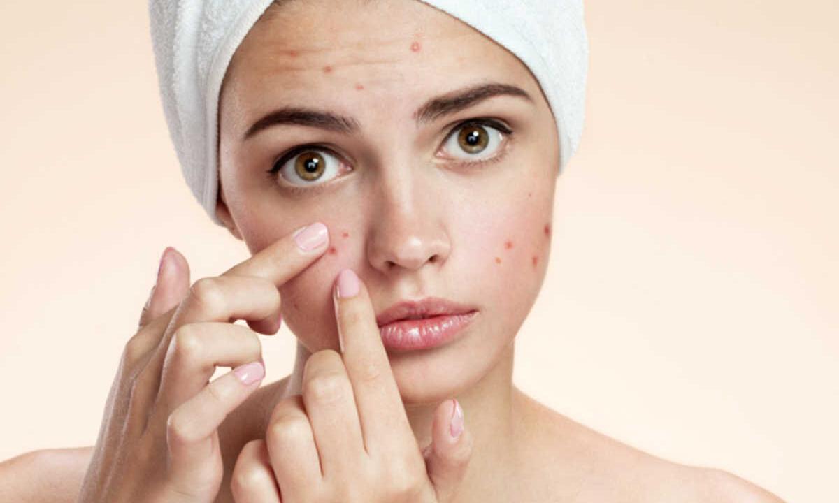 How to get rid of acne rash folk remedies