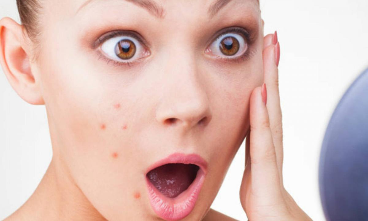 What to do with pimples on the face