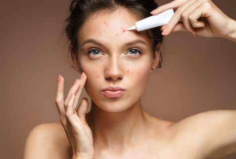 How to remove pimples from face by national method