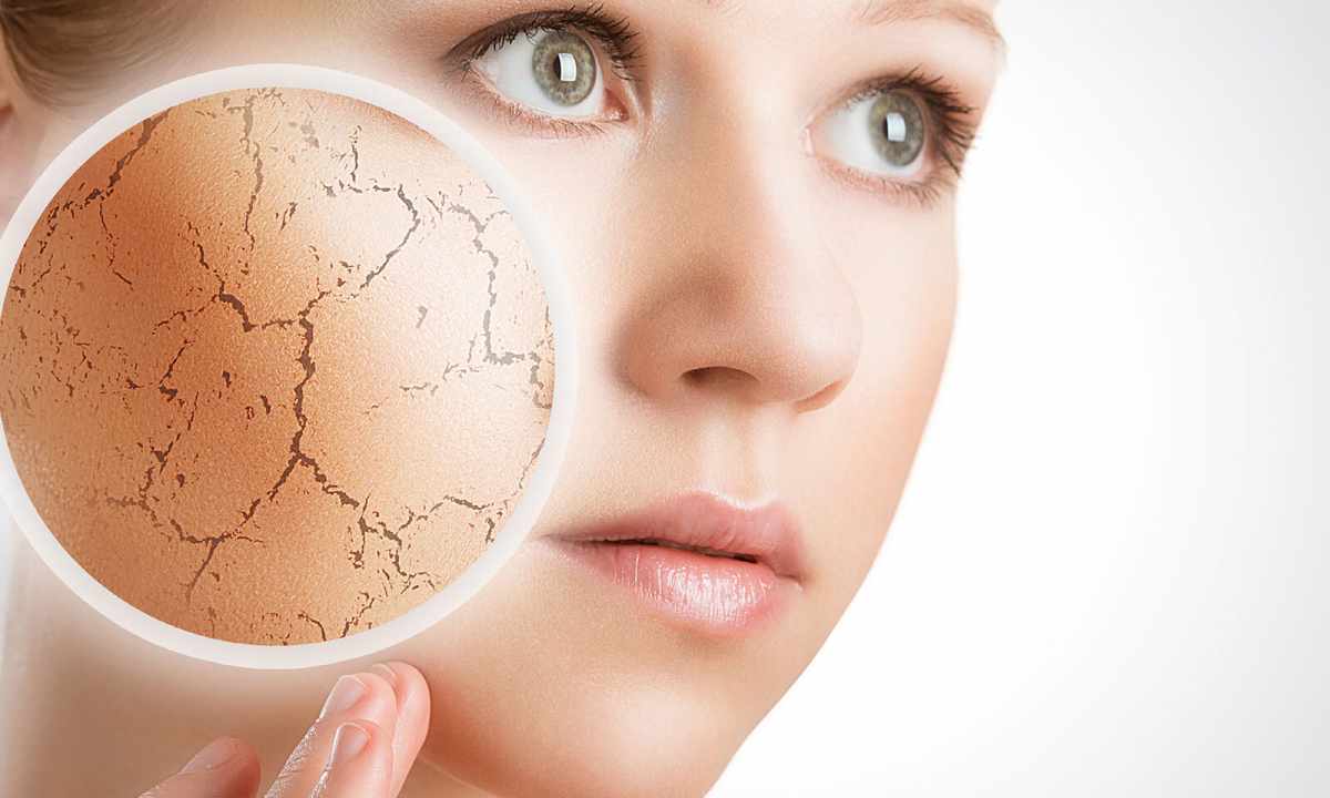 What it is necessary to know about dry face skin
