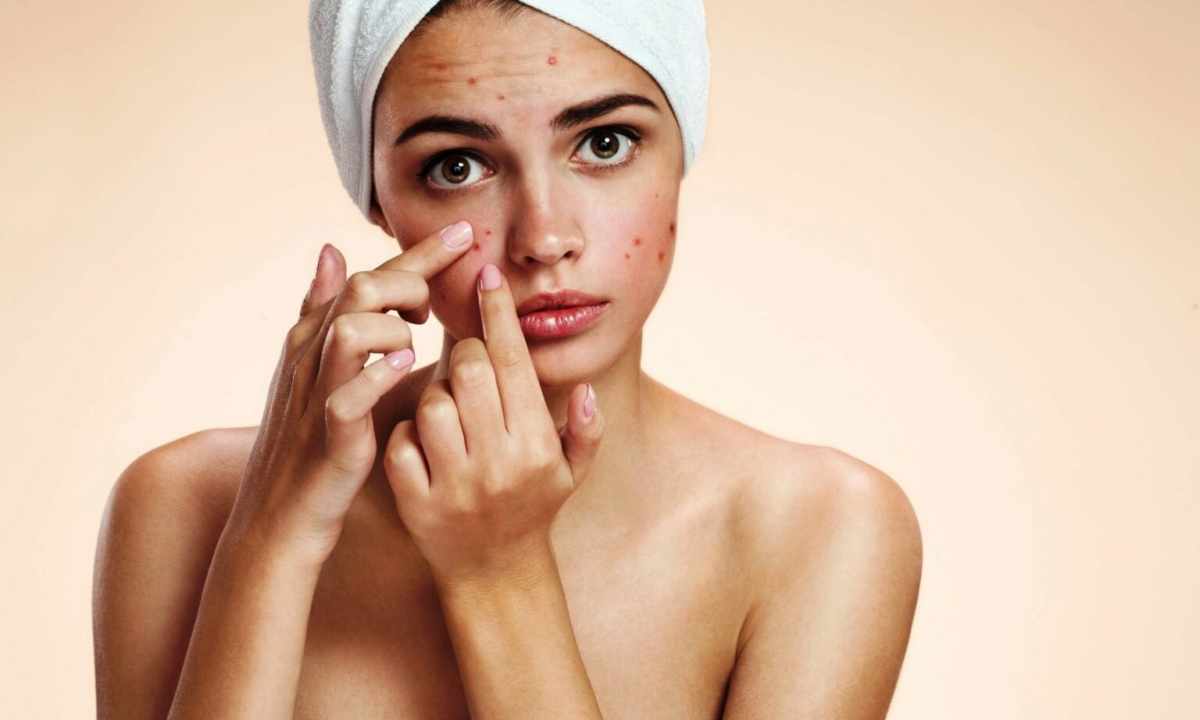 Secretion of clean and healthy face skin: masks from acne rash