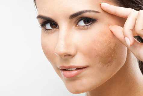 How to remove pigmentation