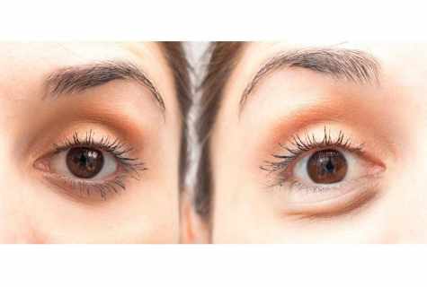 What to do when bags under eyes