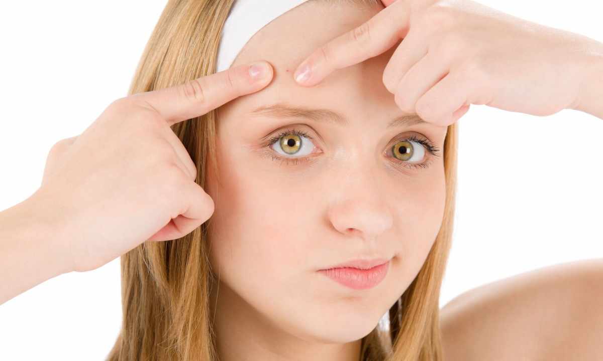 How to get rid of pimples at teenage age