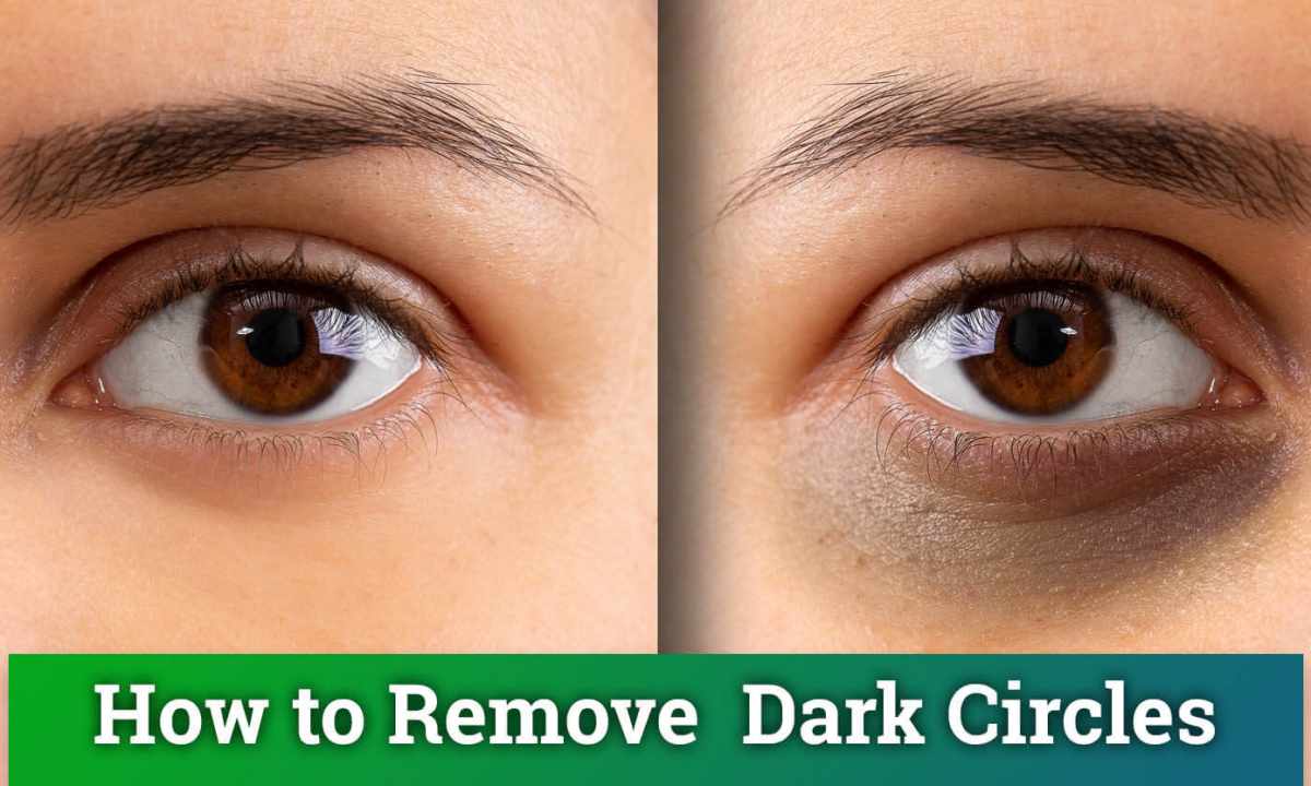 As easily and quickly to remove circles under eyes