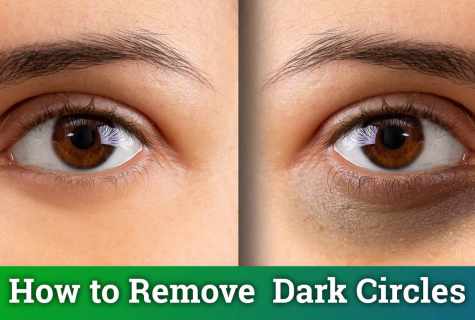 As easily and quickly to remove circles under eyes