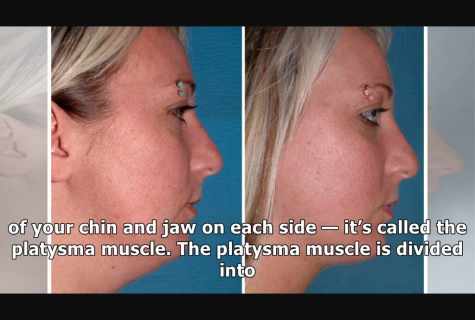 How to remove fat from chin