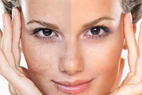 5 masks for skin rejuvenation