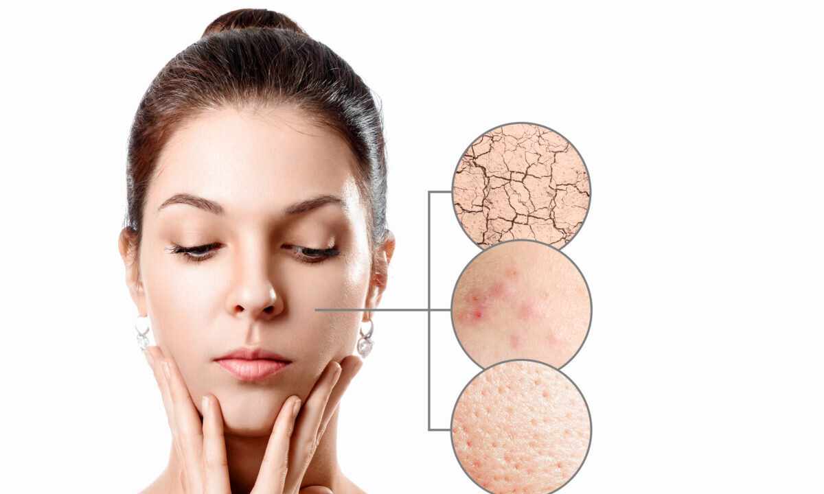 How to clean face skin from black dots