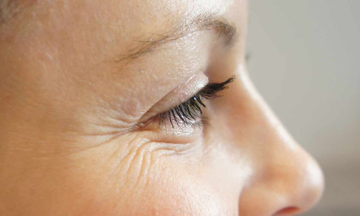 How to remove deep wrinkles under eyes
