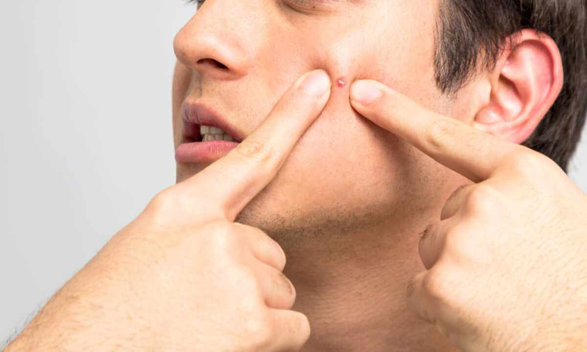 How to get rid of pimples to the man