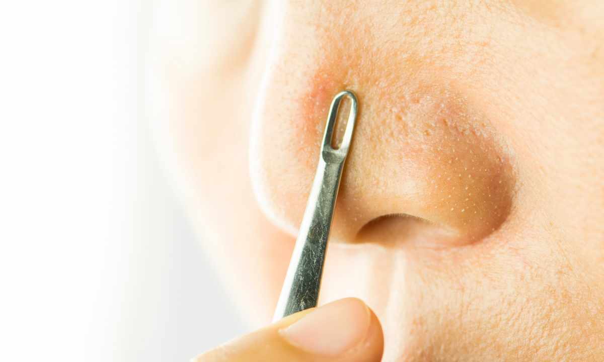 How to remove pimples on nose