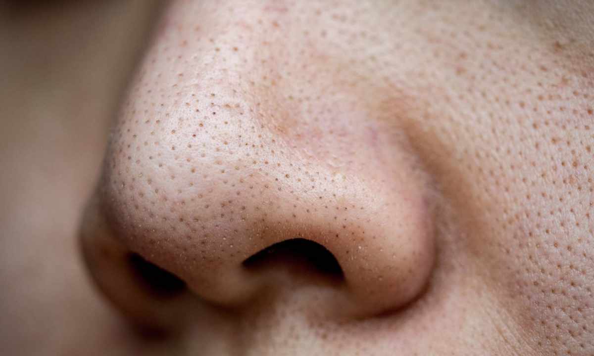 How to narrow enlarged pores