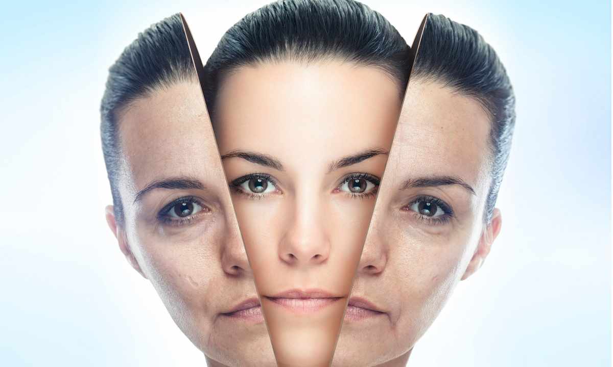 Median peeling of face: advantages and shortcomings