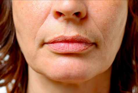 How to get rid of wrinkles over lips