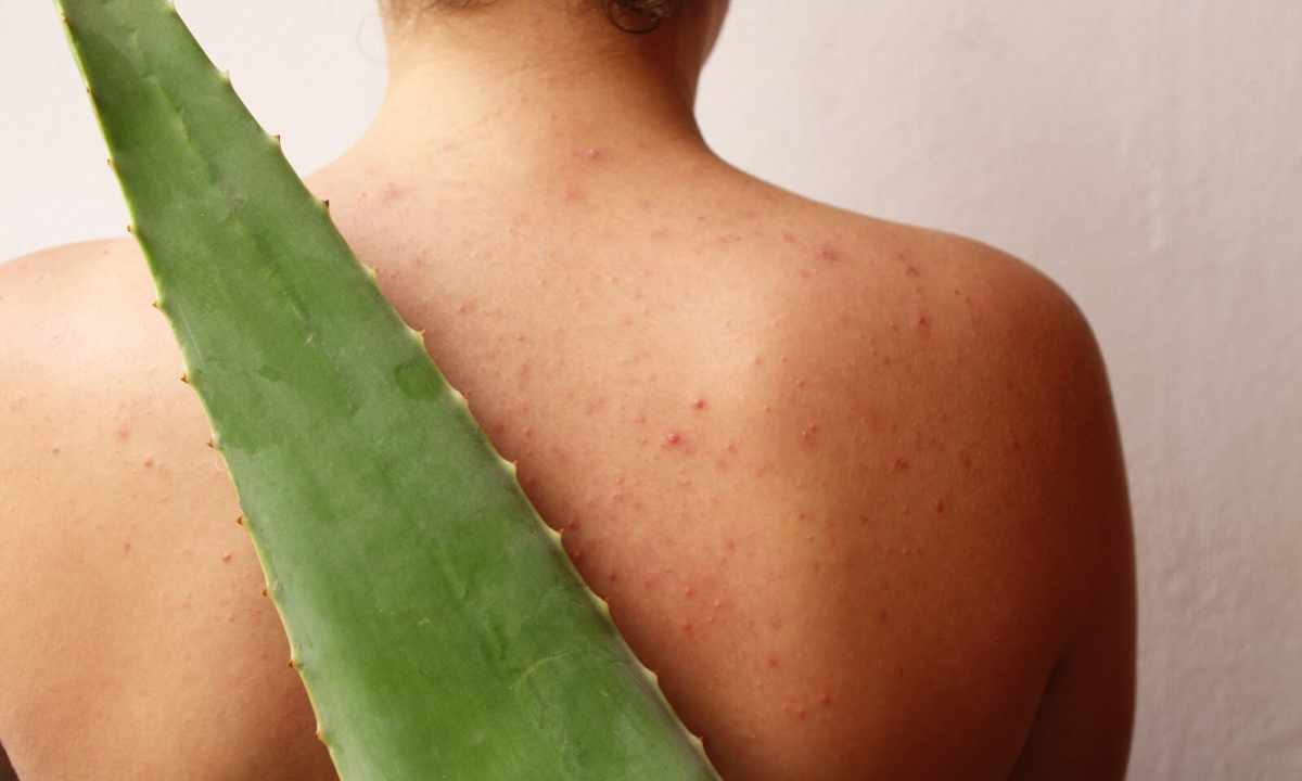 Aloe from pimples - ambulance for problem skin