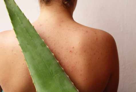 Aloe from pimples - ambulance for problem skin
