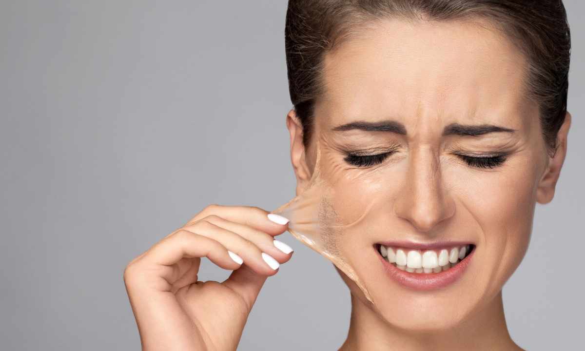 Ways of face peel: what to choose