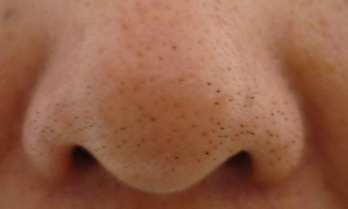 How to get rid of black dots on nose