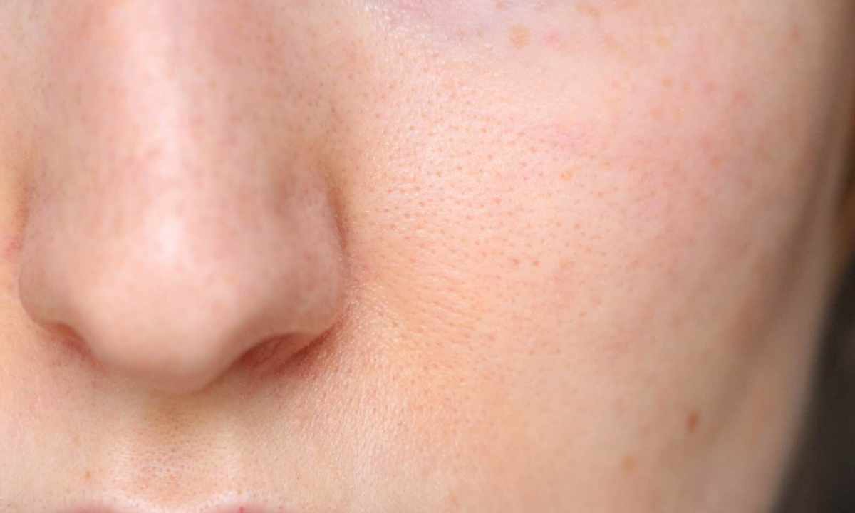 How to narrow pores on face skin