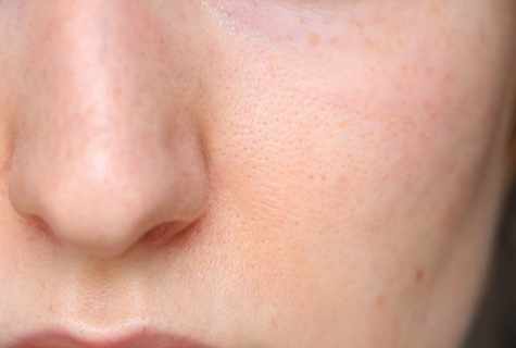 How to narrow pores on face skin