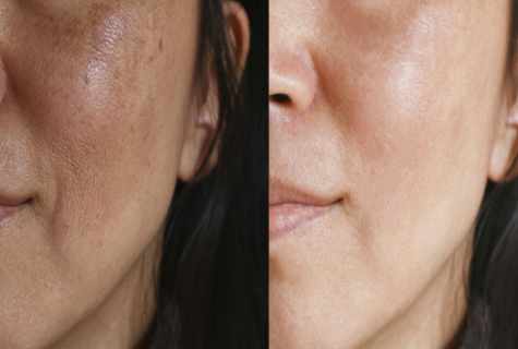 How to look after face skin after 30 flyings