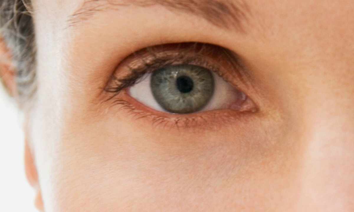 How to get rid of blue circles under eyes