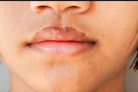 How to treat lips for dryness