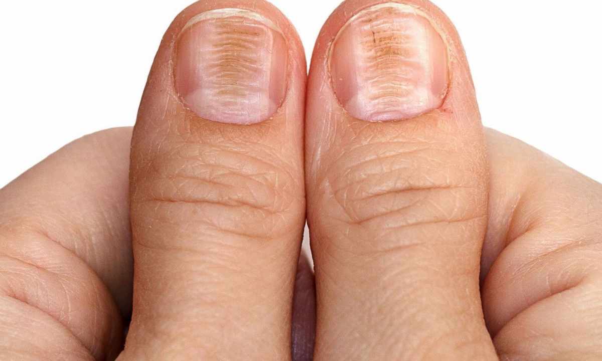 Why nails ridge