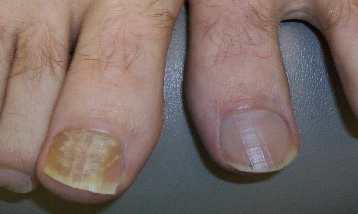 How to cure nails after building